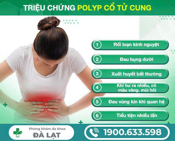 Hình ảnh minh họa